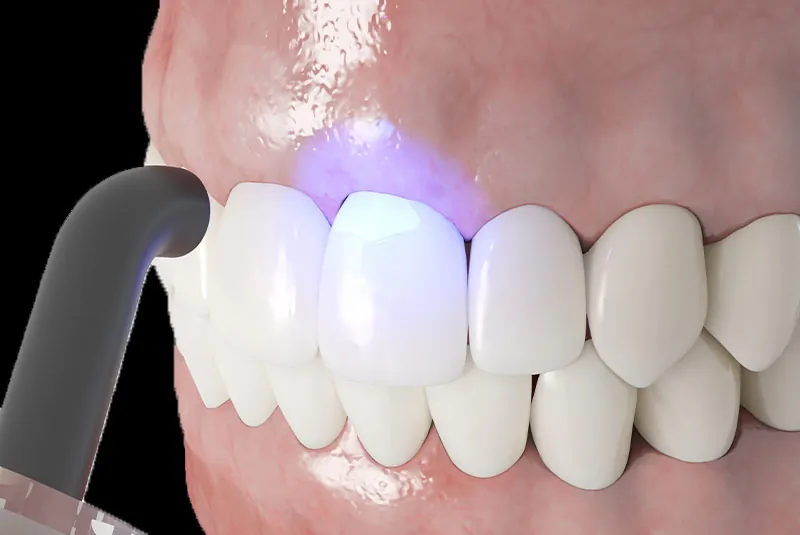 How Cosmetic Dentistry Can Correct Uneven or Misshapen Teeth